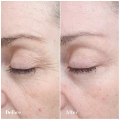 30 Day Treatment 3 x 5ml