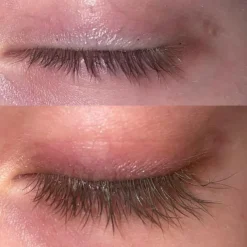 ® Eyelash Activating Serum 5ml