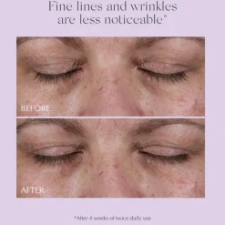 Age Reverse Total 360 Eye Contour 15g