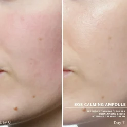 Ampoule Serum Concentrates SOS Calming 7x2ml