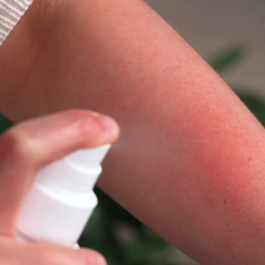 Anti Itch Spray 100ml