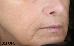 Biolumin-C Serum 59ml