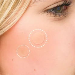 Breakout Barrier Hydrocolloid Spot Patches 26pcs