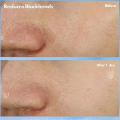Clear Improvement Blackhead Clearing Mask-To-Scrub 75ml