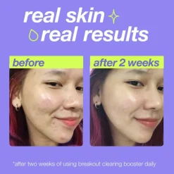 Clear Start Breakout Clearing Booster 30ml