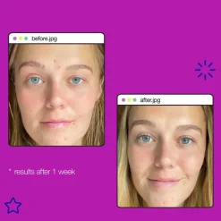 Clear Start Post-Breakout Fix 15ml