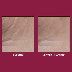 Even Smoother™ Glycolic Retinol Resurfacing Serum 30ml