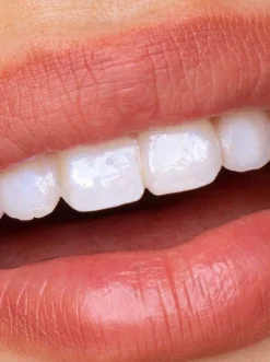 Glostik Tooth Gloss 4ml