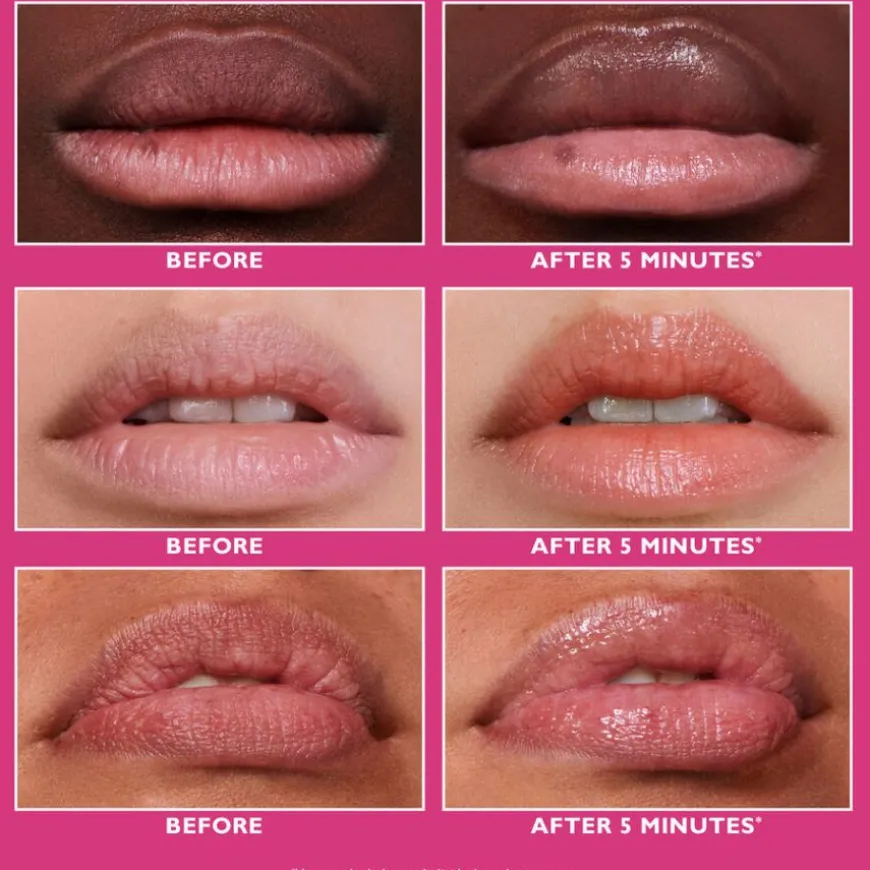 Instant FIRMx Lip Filler 10ml