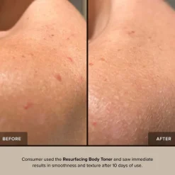 Nudebody Resurfacing Body Toner 150ml