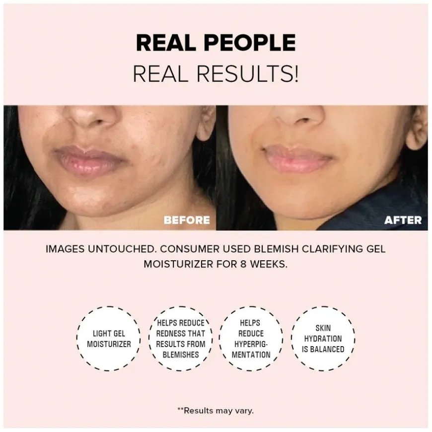 Nudeskin Blemish Clarifying Gel Moisturizer 60ml