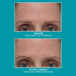 Peptide Skinjection Amplified Wrinkle-Fix Serum 30ml