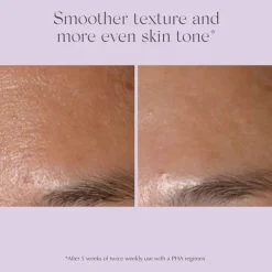 Performance Peel AP 25 26pcs