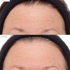 Plant Stem Cell Retinol Alternative Serum 10ml