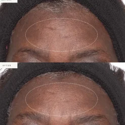 Plant Stem Cell Retinol Alternative Moisturizer 15ml