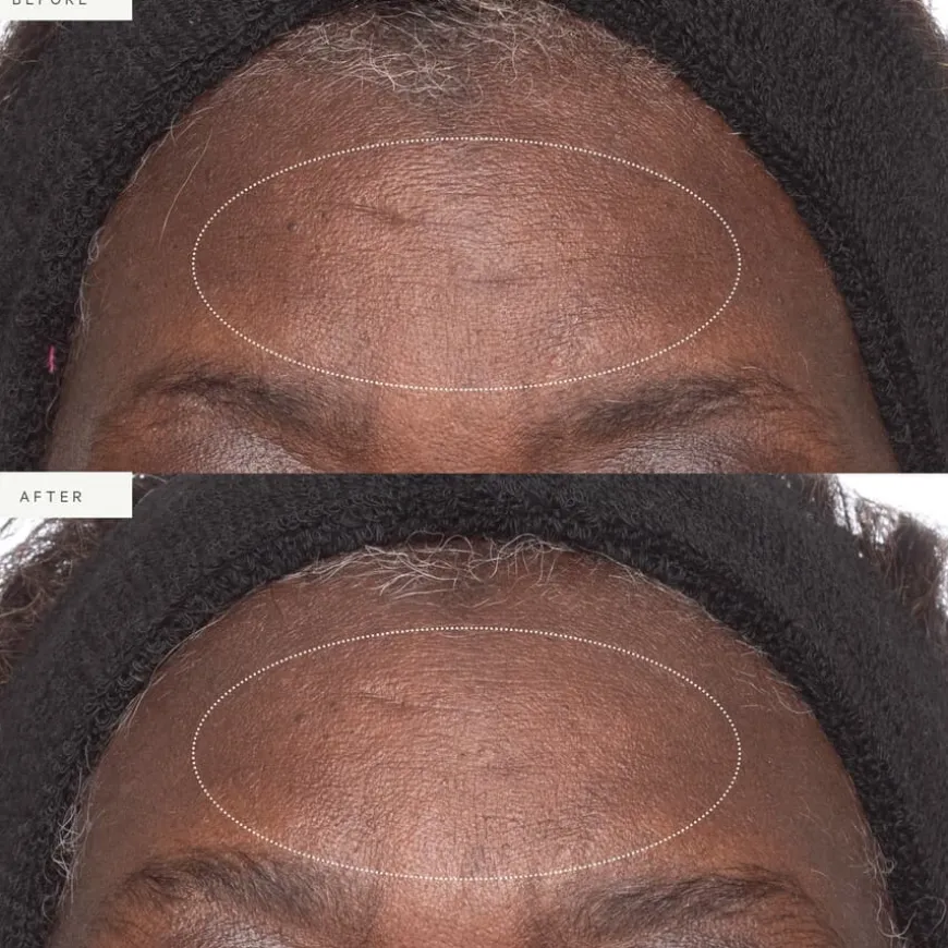 Plant Stem Cell Retinol Alternative Moisturizer 15ml