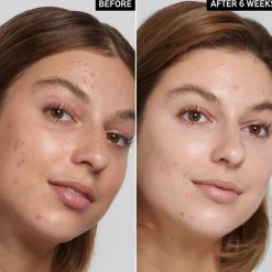 Salicylic Acid Cleanser 150ml