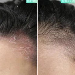 Salicylic Acid Exfoliating Scalp Treatment 150ml