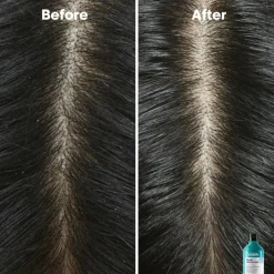 Scalp Advanced Anti-Dandruff Shampoo 300ml