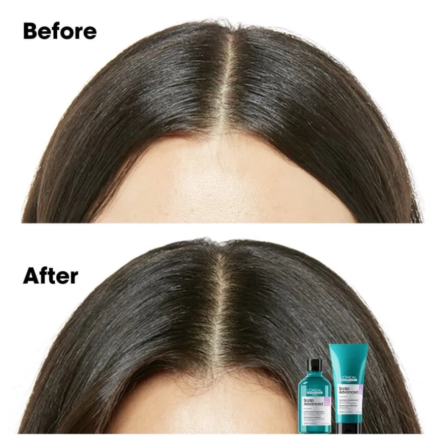 Scalp Advanced Anti-Discomfort Shampoo 300ml