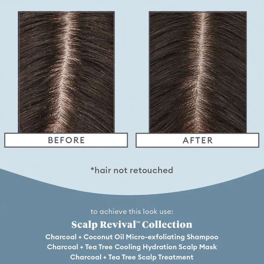 Scalp Revival™ Charcoal + Tea Tree Cooling Hydration Scalp Mask 177ml