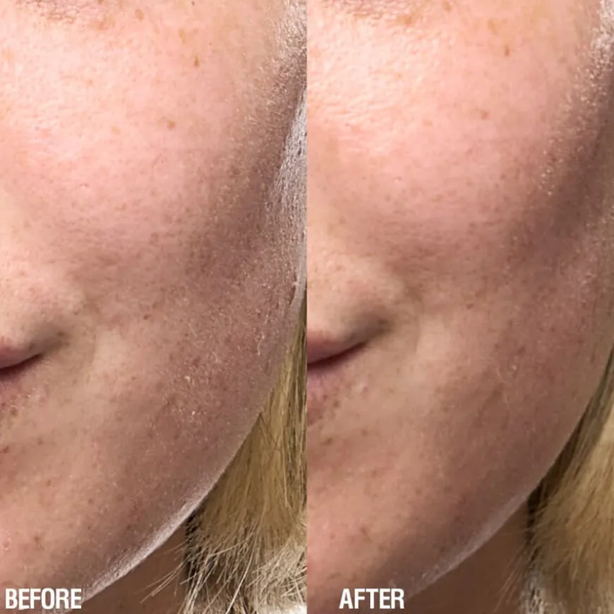 Skin Renewal Serum 25ml