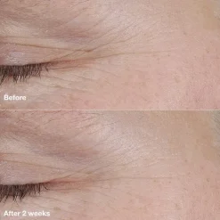 Smart Clinical Repair AM/PM Retinoid Balm 3g