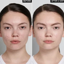 Succinic Acid Treatment 15ml