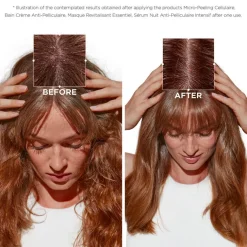 Symbiose Micro-Peeling Cellulaire 200ml