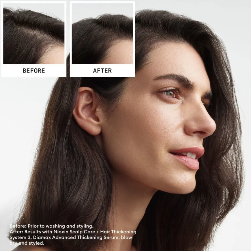 System 3 Loyalty Kit