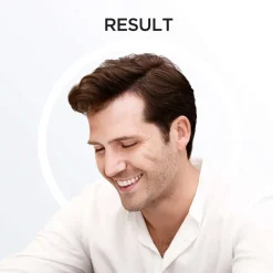 System 2 Trial Kit for Thinning Hair 1pcs