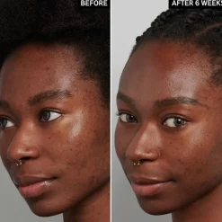 Tranexamic Acid Serum 30ml