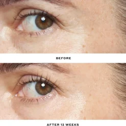 Transform Retinol Age Fighting Serum 30ml