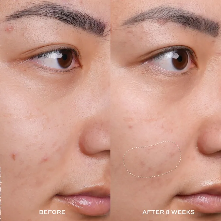 Truth Banana Bright Vitamin C Serum 30ml