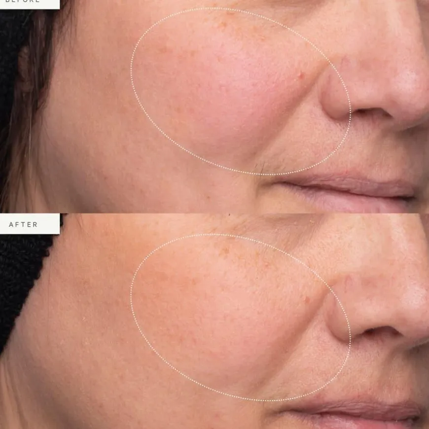 Turmeric Glow Moisturizer Refill 50ml