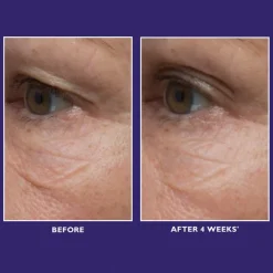 Ultimate Solution 5 Multitasking Eye Cream 15ml