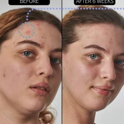 Urea 10% Moisturizer 50ml