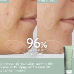 Vinopure Purifying Gel Cleanser 150ml