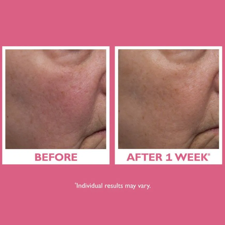 Vital-E Microbiome Age Defense Cream 50ml