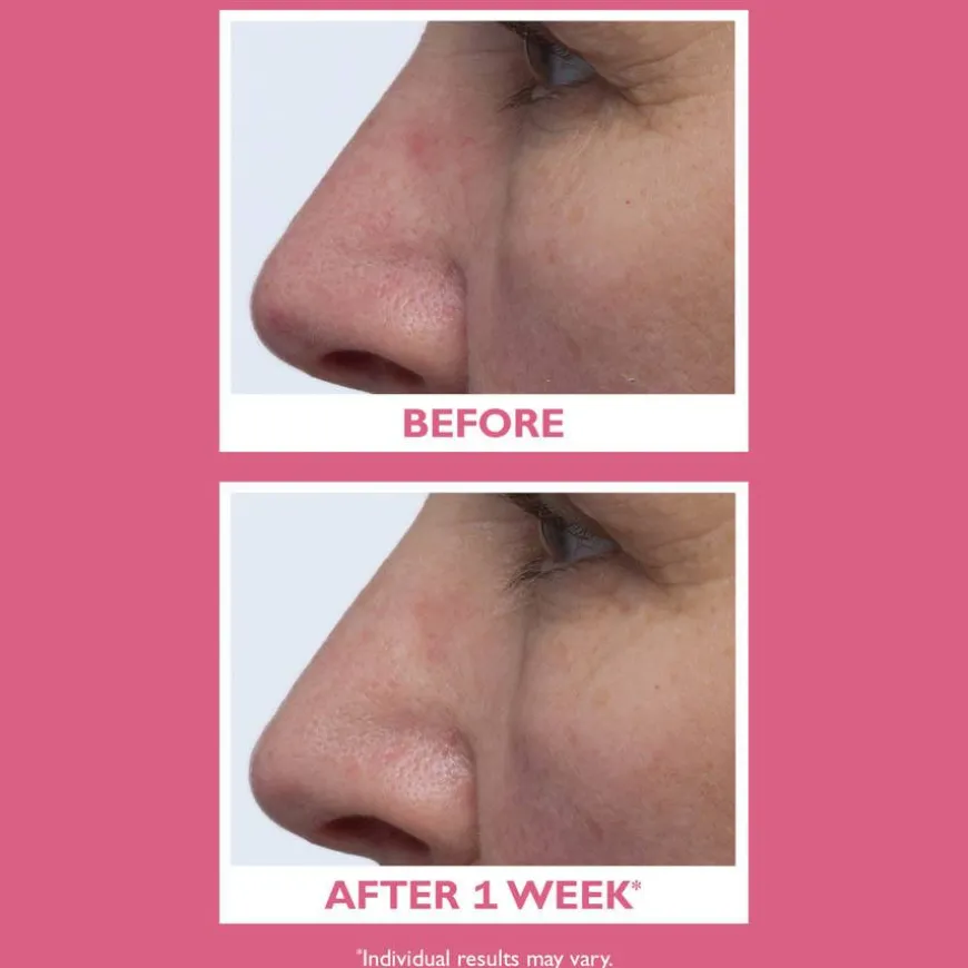 Vital-E Microbiome Age Defense Cream 50ml